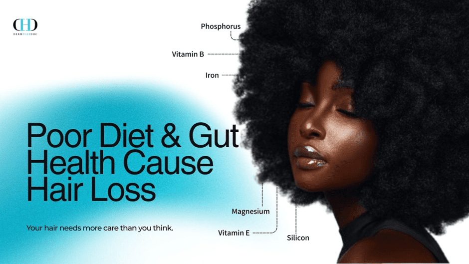 Poor Diet & Gut Health Cause Hair Loss